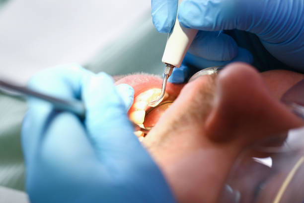 Best Weekend Emergency Dentist in Buttonwillow, CA