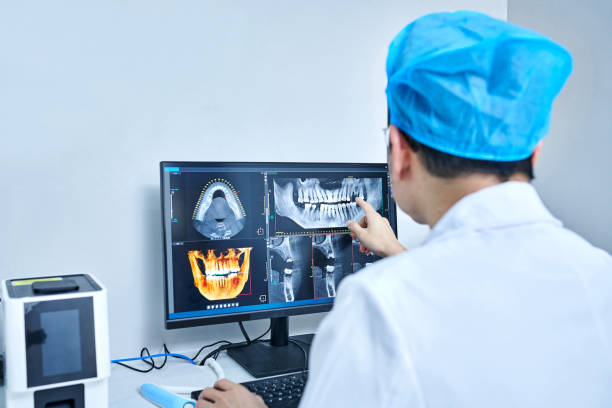 Best Emergency Tooth Extraction in Buttonwillow, CA